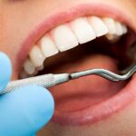 Choosing the Right Dentist in Windsor: What You Need to Know